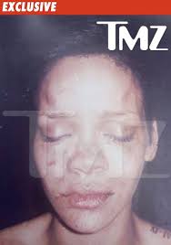 rihanna beat up pictures