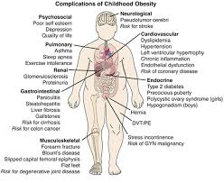 effects of obesity