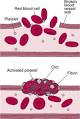 MOZAC BIOLOGY DEPARTMENT: WHAT IS BLOOD CLOTTING ?