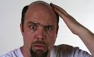 Bald Men Are They Attractive?