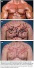 Graphic Evidence Against Steroid Abuse | Wired Science | Wired.