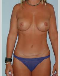 http://t2.gstatic.com/images?q=tbn:ANd9GcQ1ISCobF3vsuUiBkkubK9LMyv8MZRtz6wtlbWVOVvGm5iUzO-3DQ