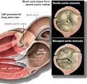 Yale Atlas of Echo- Senile aortic stenosis