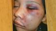 Andy Yung is accused of punching 17-year-old Jamie ... - si-bc-120307-williams-lake-rcmp-assault