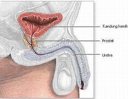 PROSTAT 