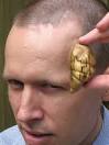 Brain Tumours | TopNews