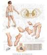 Friedreich's <b>Ataxia</b>