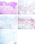 mononuclear wandering cell : KMLE yihag geomsaeg enjin - yihagsajeon, yihag ... 