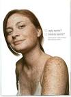 Freckles? Fabulous. A Campaign for Real Beauty. | oh no she didn'