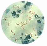 File:Streptococcus pyogenes 01.jpg - Wikipedia, the free encyclopedia