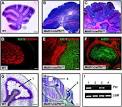 ScienceDirect.com - Cancer Cell - Medulloblastoma Can Be Initiated ...