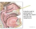 Influenza   In Depth Report   NY Times Health