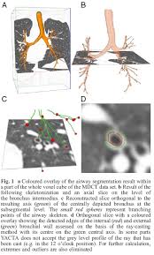 Analysis of airways in CT images; Measurement of thin structures in CT images. Figure taken from: Achenbach, Tobias; Weinheimer, Oliver; Biedermann, ...