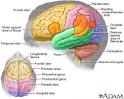<b>Brain</b> tumors are composed of