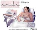 Electrocardiogram « Committed to early diagnosis and treatment of ...