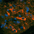  Tyrosine Hydroxylase (TH) antibody (AA116) | MVS Pacific