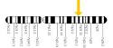 The Pingry Biology Wiki / Sarah Meyers-Cystic Fibrosis