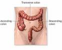 Healing through natural colon cleansing, intestinal cleanse, bowel ...