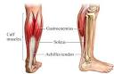 Marathon training on hold: Calf muscles revolt.
