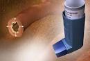 COPD Symptoms Pictures: Cough, Fatigue, Shortness of Breath ...