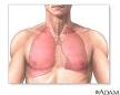 COPD (Chronic Obstructive Pulmonary Disease): MedlinePlus