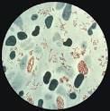 <b>Mycobacterium leprae</b> taken