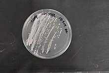 Image result for Streptomyces colombiensis