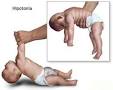 <b>Aberraciones cromosómicas</b>
