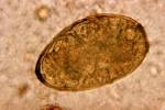 File:<b>Paragonimus westermani</b>