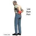 <b>Low back pain</b> is one of the