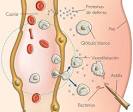<b>Inflamación</b> y formación de