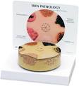 Patient Information Skin Models: Skin Acne, Skin Burns, Skin Cancer
