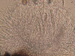 Résultat de recherche d'images pour "Zignoëlla ovoidea"