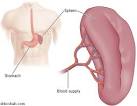 What is a <b>splenectomy</b>?
