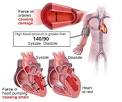 Blood Pressure Chart