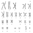 Human Cytogenetics - Chromosomes and Karyotypes