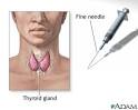 Thyroid gland biopsy