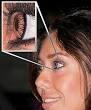 the lenses [26] This