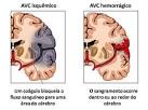 <b><b><b>Transtornos Hemostáticos</b> www.lookfordiagnosis.com