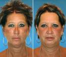 Brenda and Barb. Age: 52