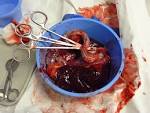 and <b>Umbilical cord</b>.jpg