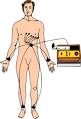 Electrocardiography - Wikipedia, the free encyclopedia