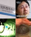 劣質硅膠：藏于體內的定時炸彈