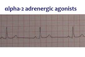 involves atropine to increase heart rate and intravenous fluid for 