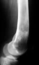 Chondrosarcoma of the Bone in dogs and cats