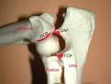 Elbow dysplasia