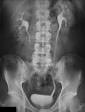 <b>Urografía</b>