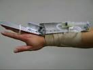 Essential <b>tremor</b>. Causes, symptoms, treatment Essential <b>tremor</b>