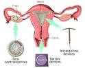 http://www.medicalook.com/diseases_images/birth-control.jpg