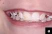 http://www.dentistrytoday.com/Media/EditLiveJava/0410_Margolis_02.jpg